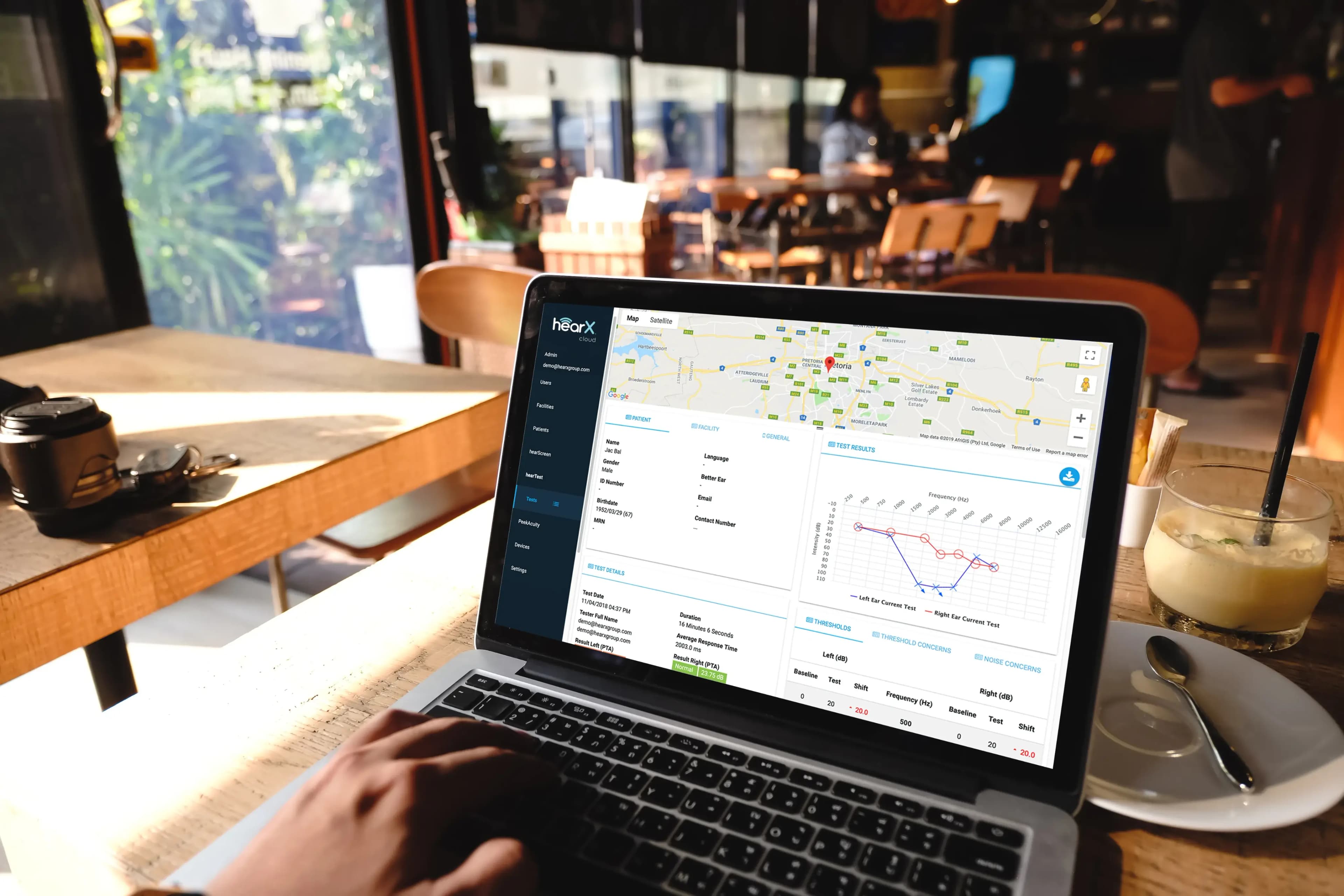 Add-on: New Audiological review service