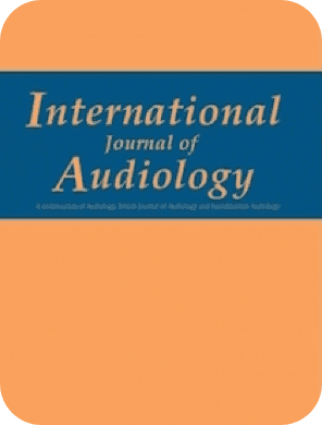 Prevalence, risk factors and causes of hearing loss among adults 50 years and older in Santiago, Chile: results from a rapid assessment of hearing loss survey