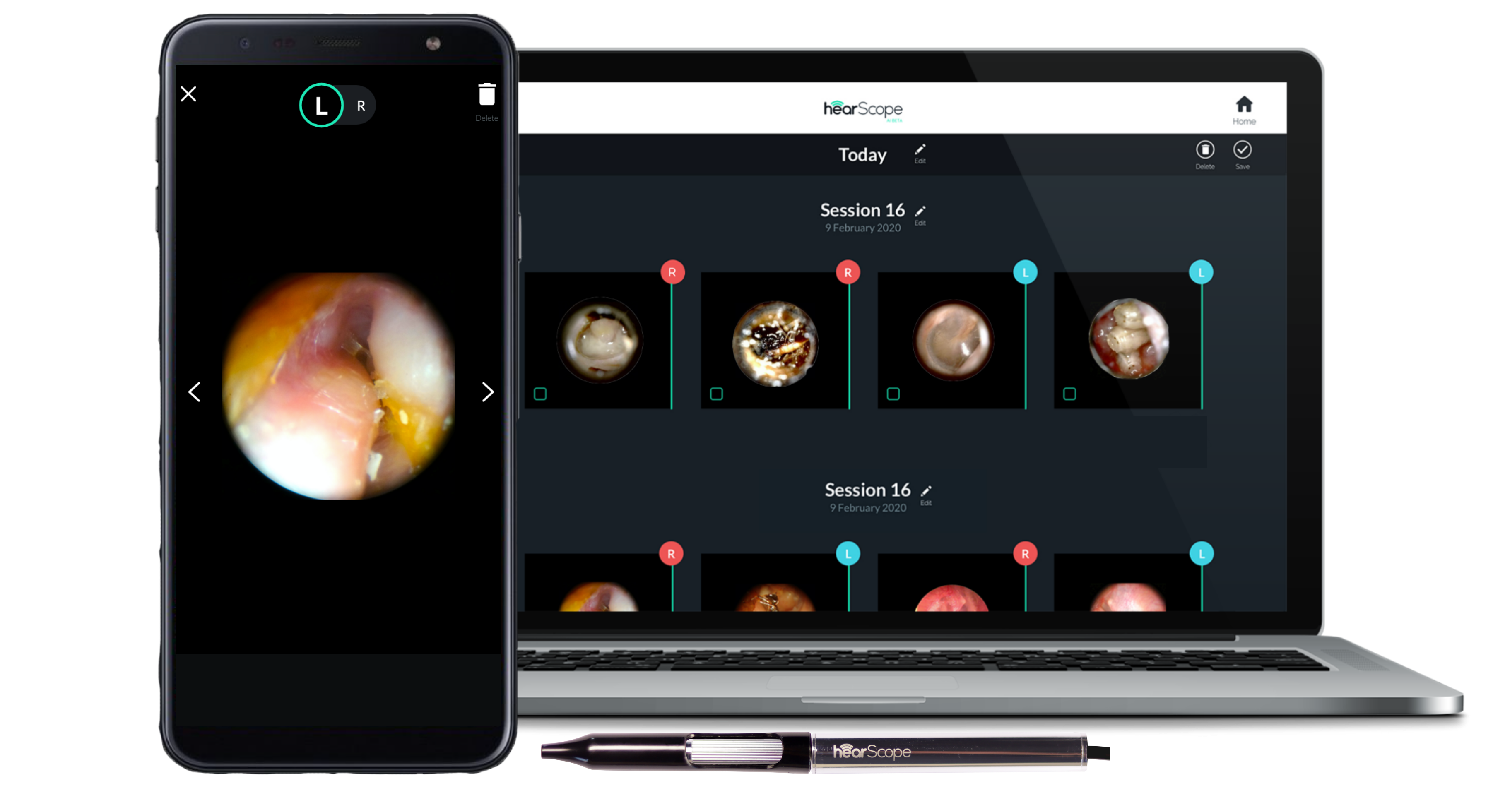 hearScope digital otoscope add-on for in-school otoscopy