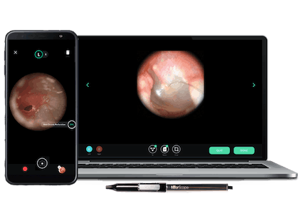 hearScope, world-first affordable digital otoscope with AI image classification