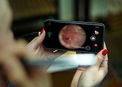 Smartphone otoscopy & AI image classification webinar Female conducting an ear exam using the hearScope digital video otoscope