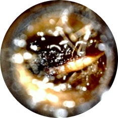 Wax Obstruction image taken with hearScope example 1