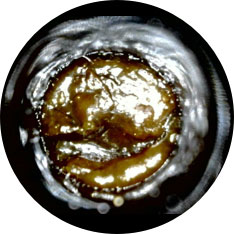 Wax Obstruction image taken with hearScope example 2