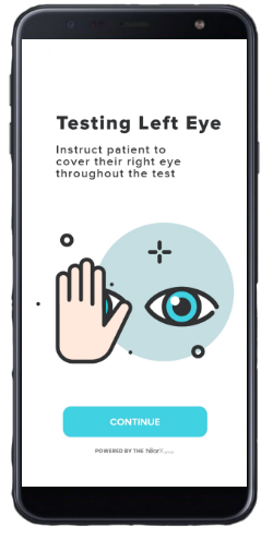 A quick eye screening on a smartphone
